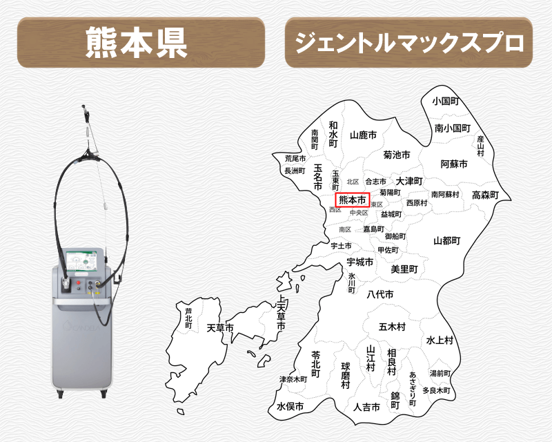 ジェントルマックスプロ 熊本県　熊本県の地名入りの白地図　導入クリニックがある市区町村に赤枠　ジェントルマックスプロの写真