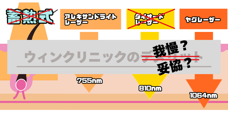 ウィンクリニックのデメリット改め 我慢 妥協　蓄熱式とアレキサンドライトレーザーとダイオードレーザーとヤグレーザーのイメージイラスト