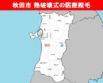 秋田県の白地図　秋田市に赤枠
