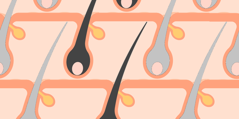 硬毛化　イメージイラスト