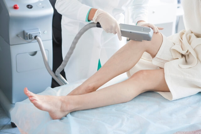 脱毛で膝下に照射されている女性　写真