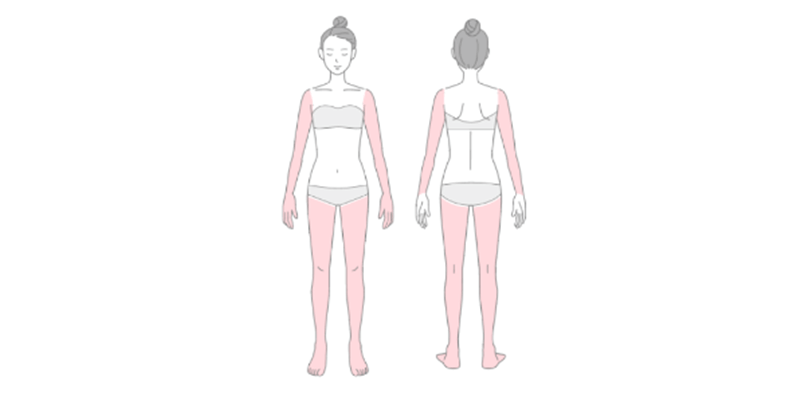 ウィンクリニック　腕・脚・ワキセットプラン　範囲　画像